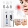 Electric Small Bubble Blackhead Remover