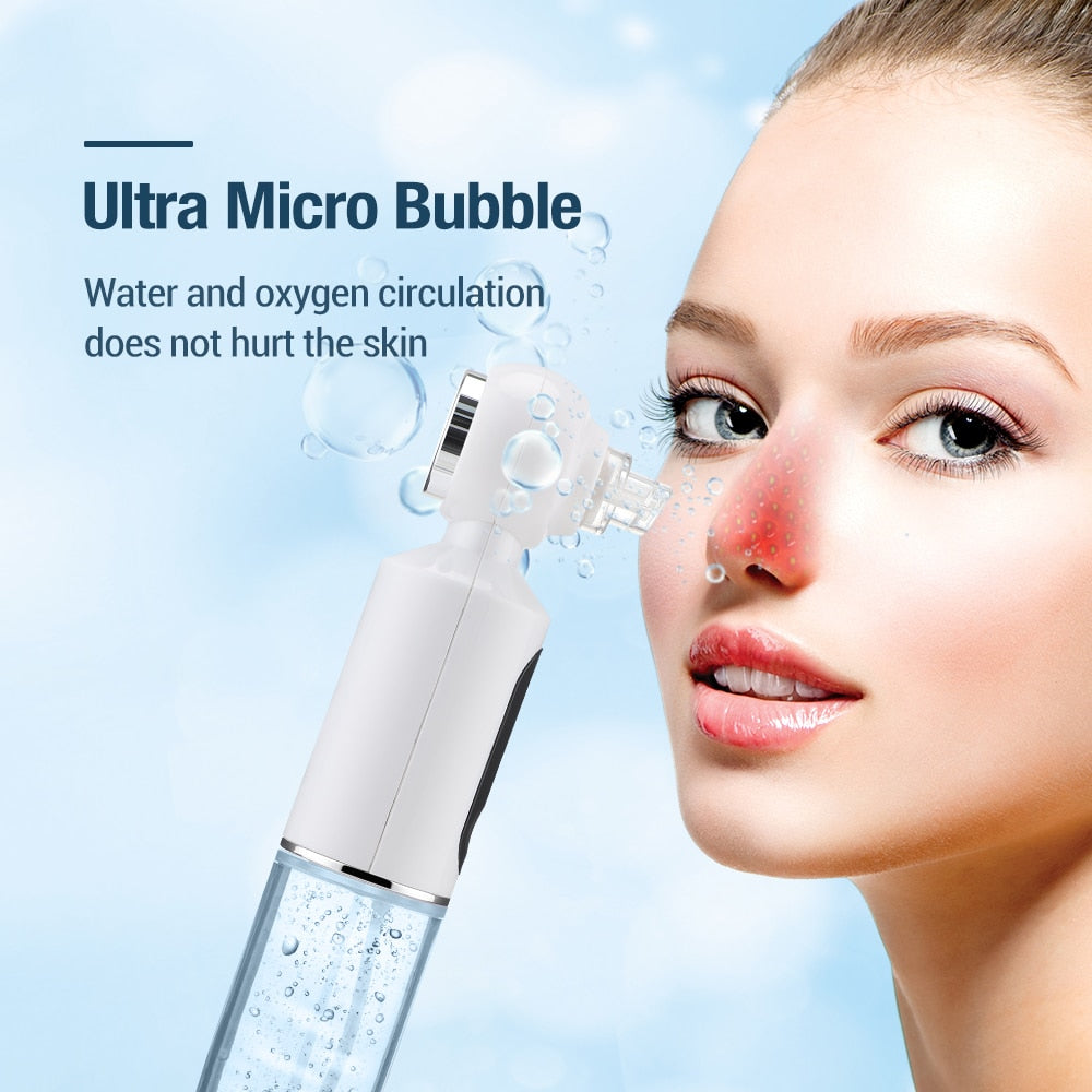 Electric Small Bubble Blackhead Remover