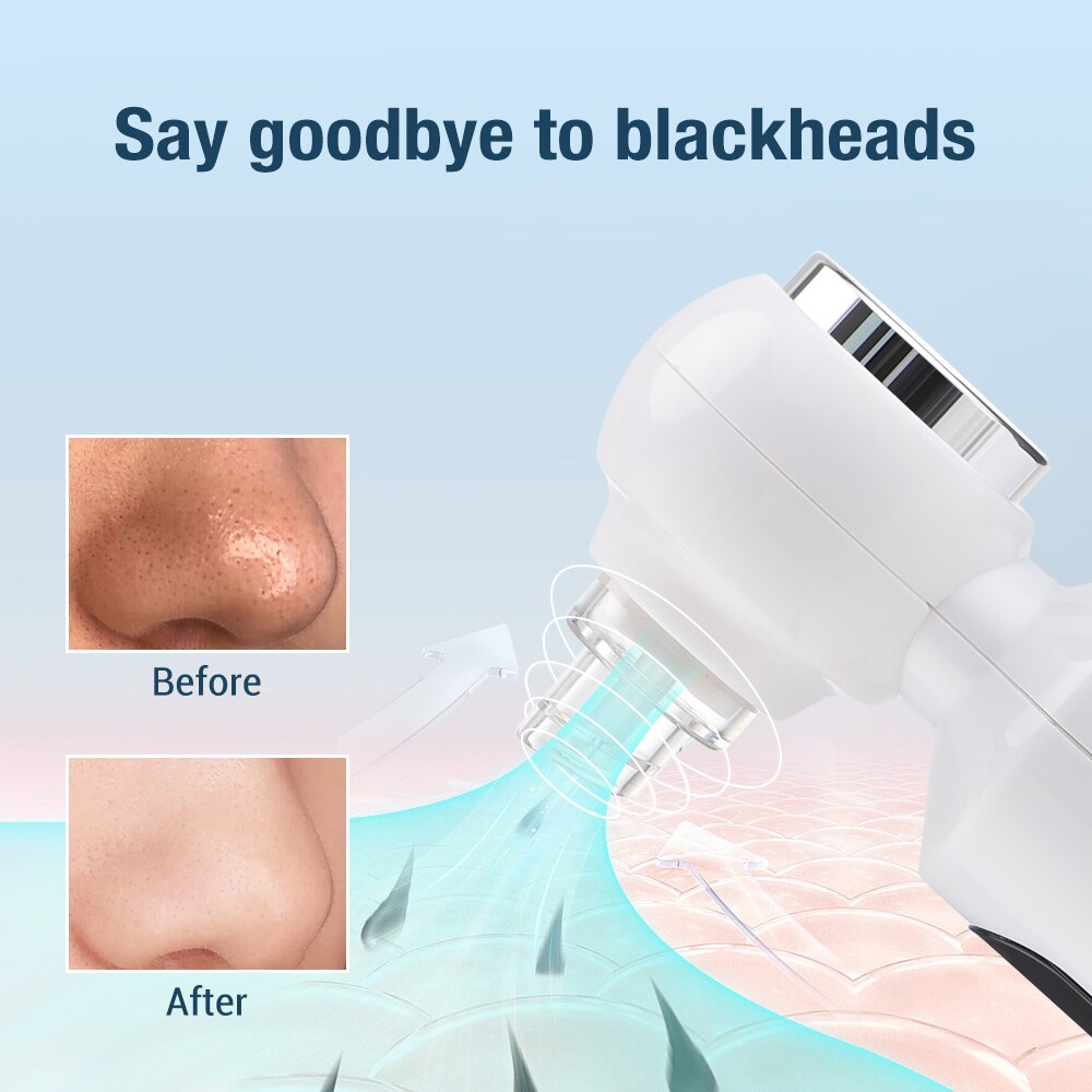 Electric Small Bubble Blackhead Remover