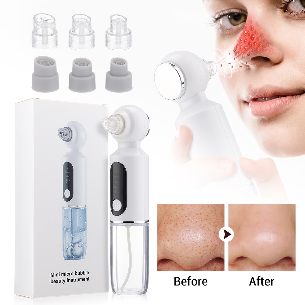 Electric Small Bubble Blackhead Remover